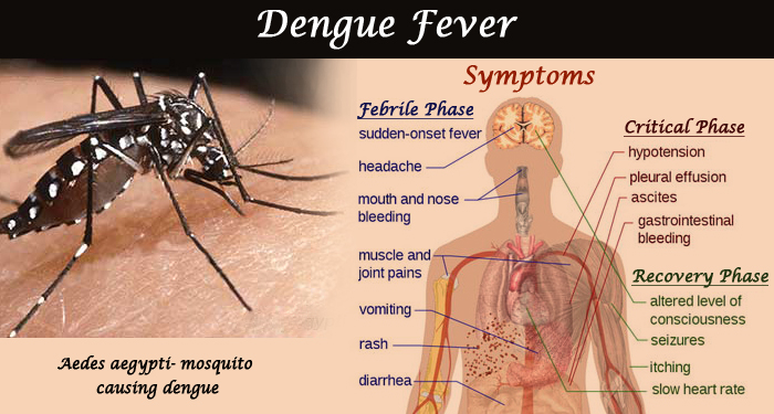 सावधान ! बुटवलमा डेंगुको महामारी : सोमबार सम्म ४ सय १०मा संक्रमण, ७५ प्रतिशत बिरामी बुटवल उप-महानगरका भित्रका
