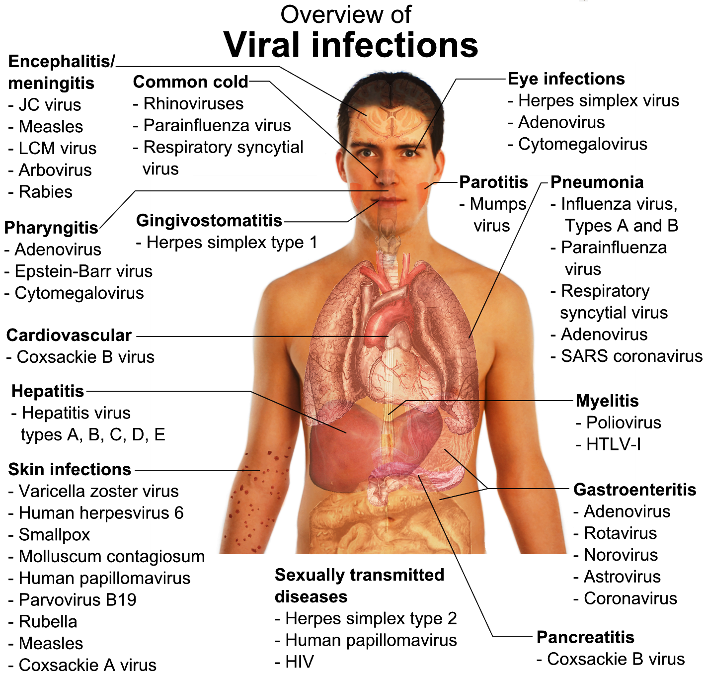 बाजुरा,जाजरकोट लगातका बासिन्दामा फैलिएको भाइरल  H3N2भाइरस किटाणुको सक्रमण भएको प्रमाणित, कालीकोटमा औषधी पुग्यो, जनशक्ती पुगेन